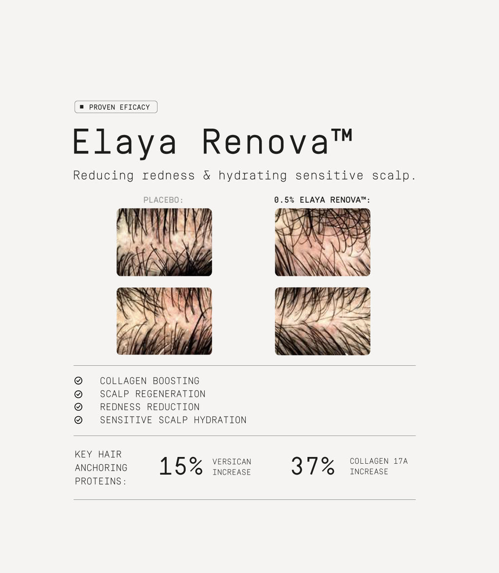 Scalp Activation Treatment